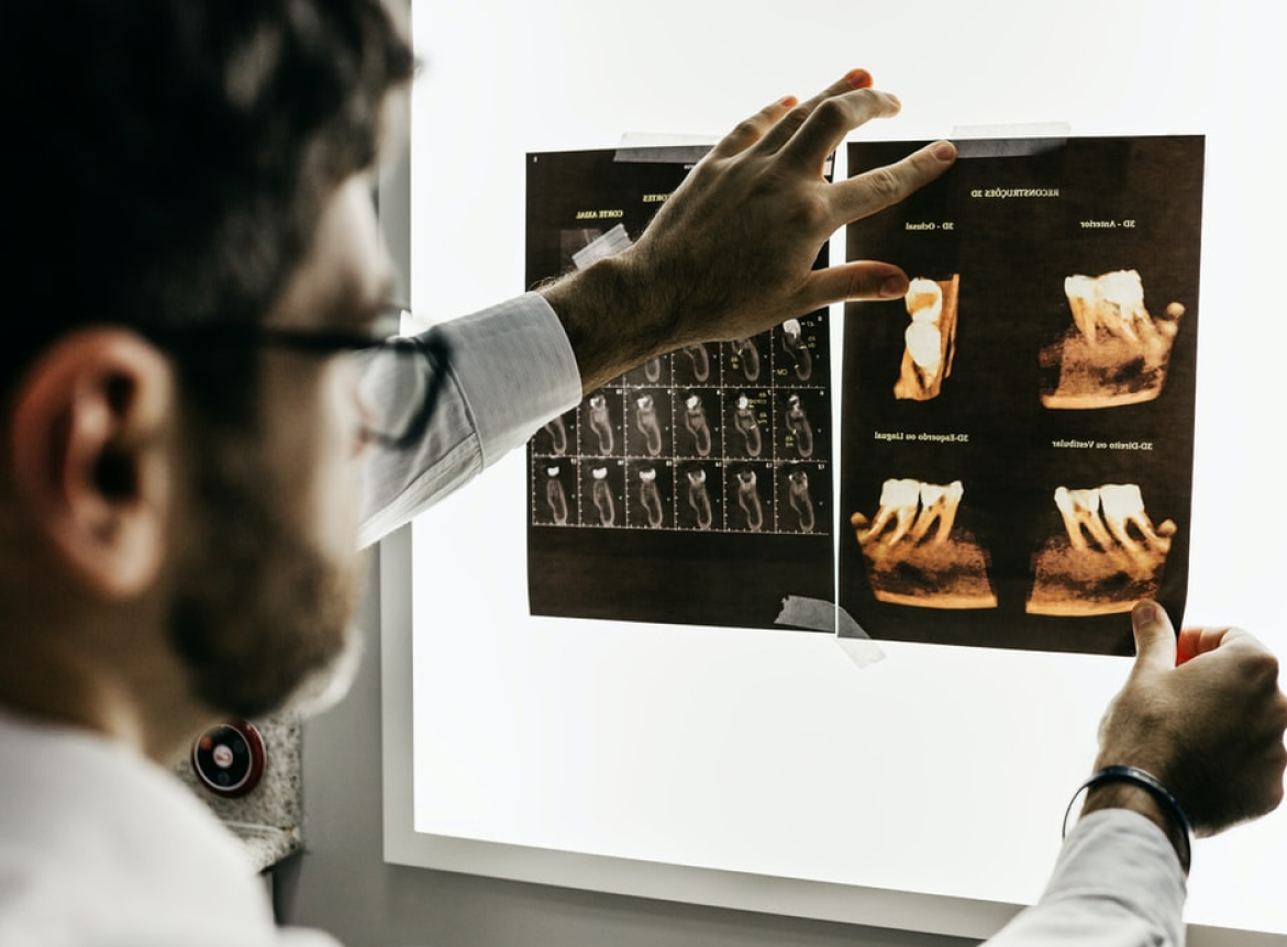 Dentist examining x-ray